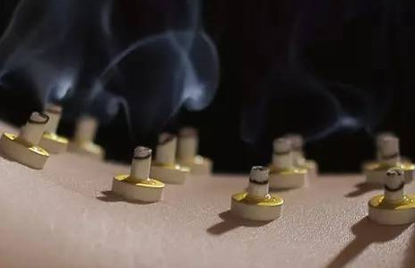 艾灸是什么呢？